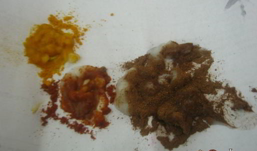 пасхальные яйца