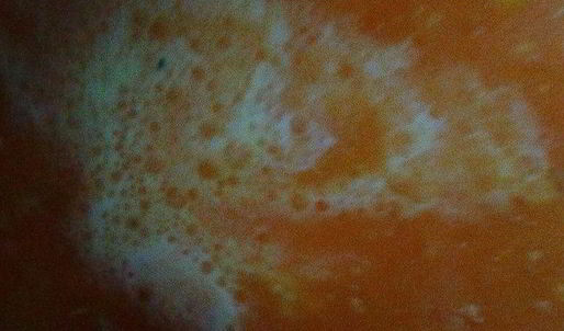 суп-пюре из тыквы с фрикадельками